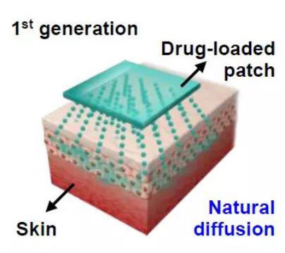 第一代透皮给药技术：通过药物的自然扩散.jpg